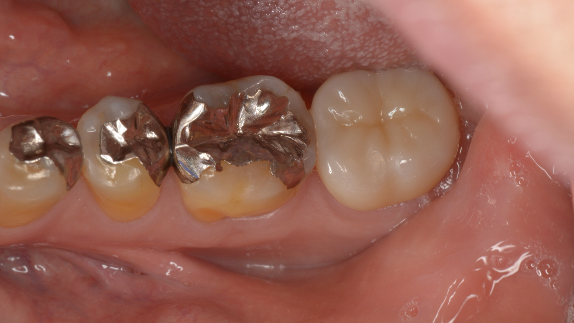 Before Image