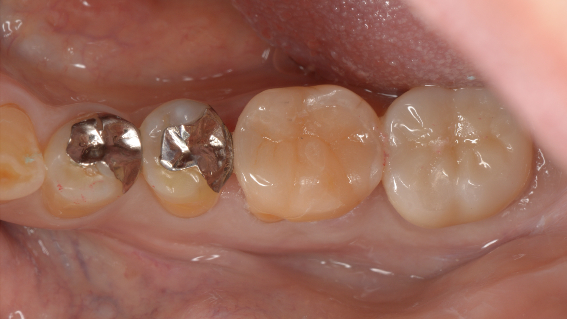 After Image