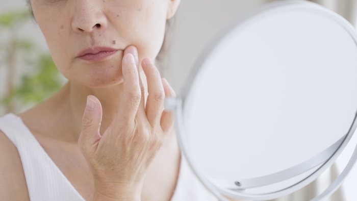 ほうれい線を気にしている女性